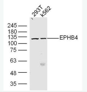 Anti-EPHB4  antibody-酪氨酸蛋白激酶受体B4抗体,EPHB4