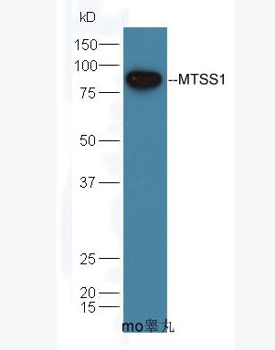 Anti-MTSS1 antibody-腫瘤轉(zhuǎn)移抑制蛋白1,MTSS1