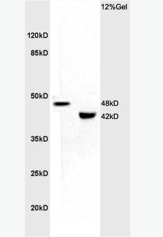 Anti-KCNN4 antibody-鈣激活鉀通道蛋白4抗體,KCNN4