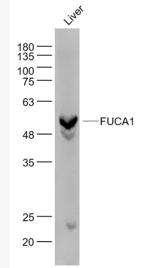 Anti-FUCA1  antibody-α-L岩藻糖苷酶抗体,FUCA1