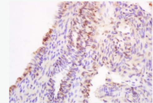 Anti-HOXA11 antibody-同源盒蛋白HOXA11抗体,HOXA11