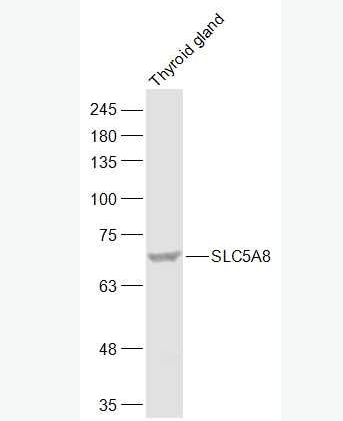 Anti-SLC5A8 antibody-钠碘转运体蛋白8抗体,SLC5A8