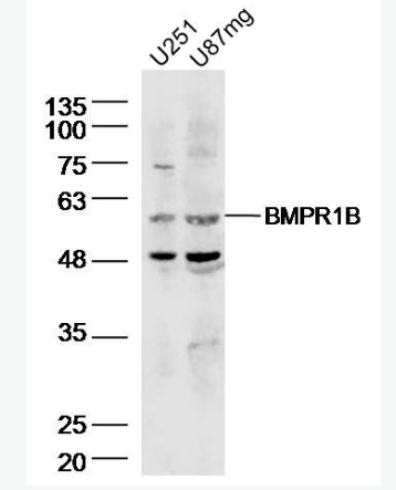 Anti-BMPR1B antibody-骨形态发生蛋白受体1B抗体,BMPR1B