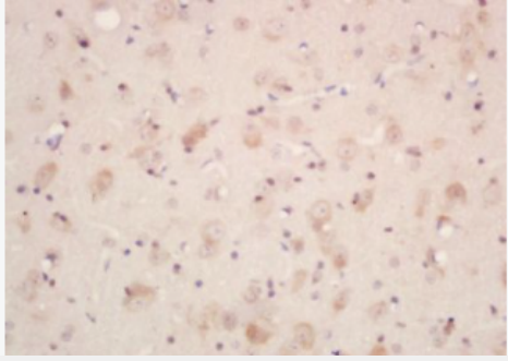 Anti-Neurotensin antibody-神经紧张素抗体,Neurotensin