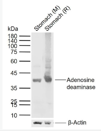 Anti-Adenosine deaminase antibody-腺苷脱氨酶(ADA)抗体,Adenosine deaminase
