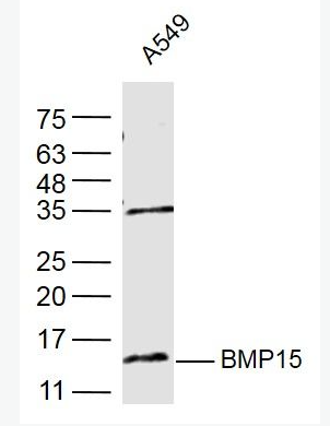 Anti-BMP15 antibody-骨形態(tài)發(fā)生蛋白15抗體,BMP15