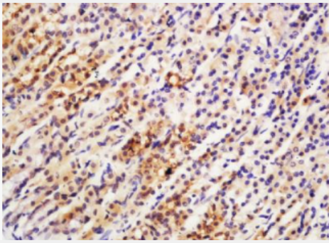 Anti-ARL11 antibody-ADP核糖基化因子樣11抗體,ARL11