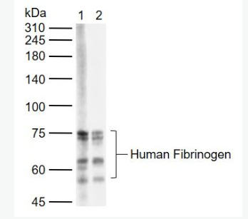 Anti-human Fibrinogen antibody-羊抗人纤维蛋白原抗体,human Fibrinogen