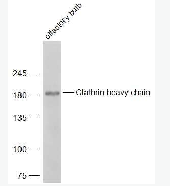 Anti-Clathrin heavy chain antibody-网格蛋白重链抗体,Clathrin heavy chain