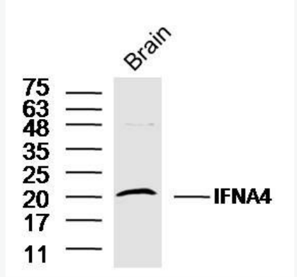 Anti-IFNA4 antibody-干扰素α4抗体,IFNA4