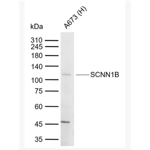 Anti-SCNN1B antibody-上皮钠通道β抗体