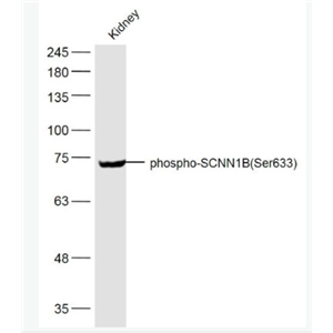 Anti-phospho-SCNN1B (Ser633) antibody-磷酸化上皮钠通β抗体,phospho-SCNN1B (Ser633)