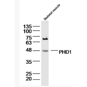 Anti-PHD1 antibody-脯氨酰羟化酶抗体