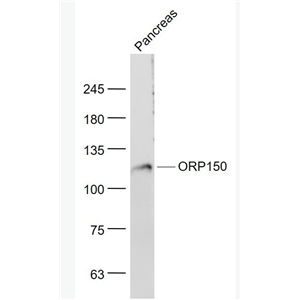 Anti-ORP150 antibody-氧气调节蛋白150抗体,ORP150