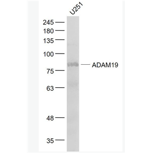Anti-ADAM19 antibody-去整合素样金属蛋白酶19抗体