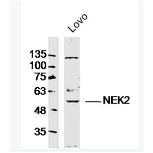 Anti-NEK2 antibody-中心体相关蛋白激酶Nek2抗体,NEK2