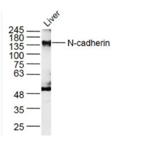 Anti-N-cadherin antibody-N-钙粘附分子抗体.