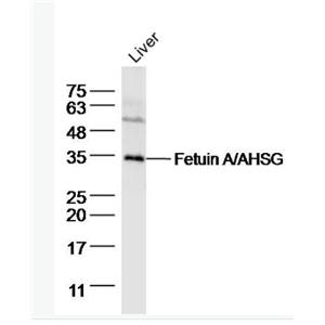 Anti-Fetuin A/AHSG antibody-胎球蛋白A
