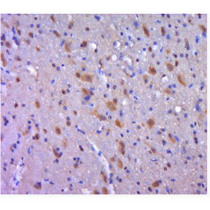 Anti-AIMP2  antibody-AIMP2抗体