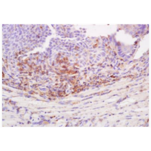 Anti-Desmoglein 3 antibody-桥粒芯蛋白3抗体