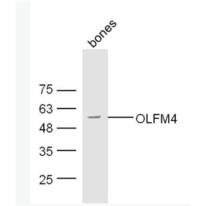 Anti-OLFM4 antibody-抗细胞凋亡蛋白OLFM44抗体