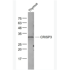 Anti-CRISP3 antibody-富含半胱氨酸分泌蛋白3抗体