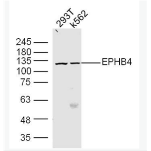 Anti-EPHB4  antibody-酪氨酸蛋白激酶受体B4抗体