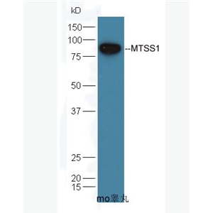 Anti-MTSS1 antibody-肿瘤转移抑制蛋白1