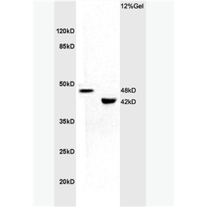 Anti-KCNN4 antibody-钙激活钾通道蛋白4抗体