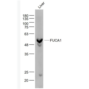Anti-FUCA1  antibody-α-L岩藻糖苷酶抗体