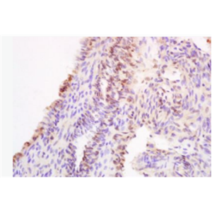 Anti-HOXA11 antibody-同源盒蛋白HOXA11抗体
