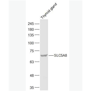 Anti-SLC5A8 antibody-钠碘转运体蛋白8抗体