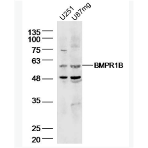 Anti-BMPR1B antibody-骨形态发生蛋白受体1B抗体