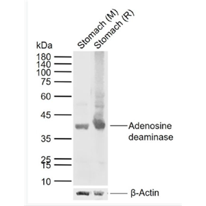 Anti-Adenosine deaminase antibody-腺苷脱氨酶(ADA)抗体