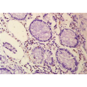 Anti-n-Myc antibody-致癌基因n-Myc抗体