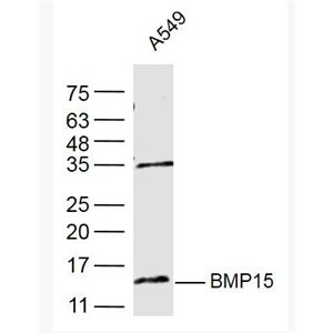 Anti-BMP15 antibody-骨形态发生蛋白15抗体