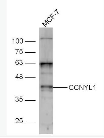 Anti-CCNYL1 antibody-周期素样Y1抗体,CCNYL1