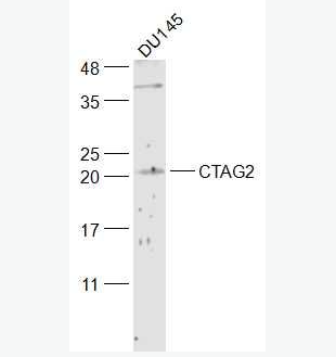 Anti-CTAG2 antibody-肿瘤/睾丸抗原2抗体,CTAG2