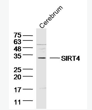 Anti-SIRT4 antibody-沉默調(diào)節(jié)相關(guān)蛋白4抗體,SIRT4