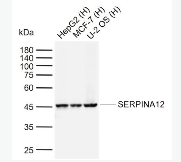 Anti-SERPINA12 antibody-内脏脂肪组织源性丝氨酸蛋白酶抑制蛋白抗体,SERPINA12