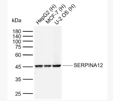 Anti-SERPINA12 antibody-內(nèi)臟脂肪組織源性絲氨酸蛋白酶抑制蛋白抗體,SERPINA12