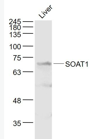 Anti-SOAT1 antibody-膽固醇酰基轉(zhuǎn)移酶1抗體,SOAT1