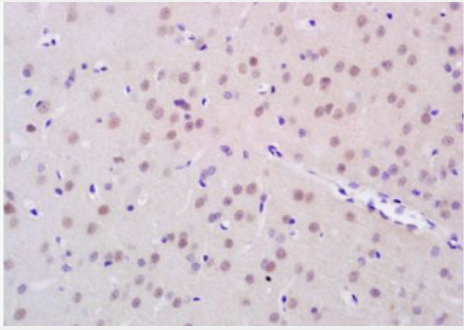 Anti-FTO antibody-脂肪堆積和肥胖相關(guān)蛋白抗體,FTO