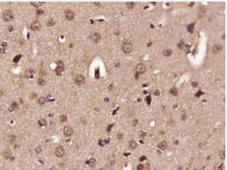 Anti-ELOVL2 antibody-长链脂肪酸延长酶ELOVL2抗体,ELOVL2