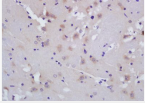 Anti-ALOX5AP antibody-5脂氧合酶激活蛋白抗体,ALOX5AP