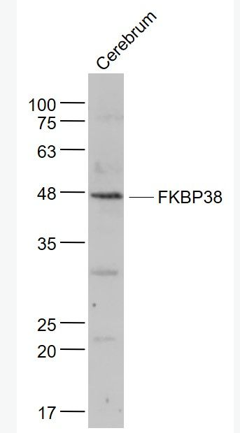 Anti-FKBP38 antibody-FK506结合蛋白38抗体,FKBP38