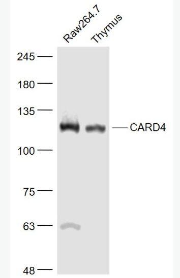 Anti-CARD4 antibody-凋亡加强结构域蛋白4抗体,CARD4