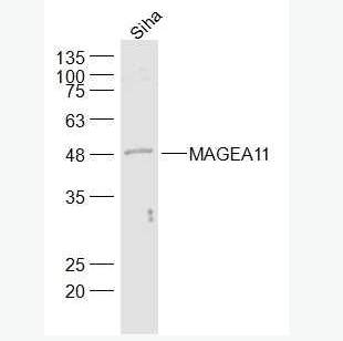 Anti-MAGEA11 antibody-黑色素瘤相关抗原11抗体,MAGEA11