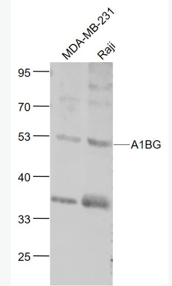 Anti-A1BG antibody-α1B糖蛋白抗体,A1BG
