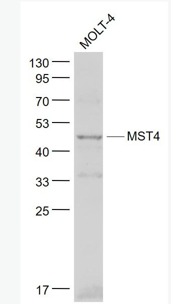 Anti-MST4 antibody-絲氨酸/蘇氨酸蛋白激酶MST4抗體,MST4